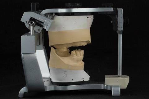 Figure 68. Definitive casts mounted in centric relation.