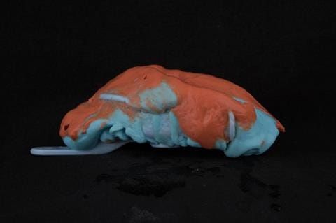 Figure 19. Maxillary primary impression made in two stages using Accudent XD, Ivoclar. This overextends the impression and captures the full depth of the sulcus. Please note this is from a different patient as I did not photograph the primary impressions.