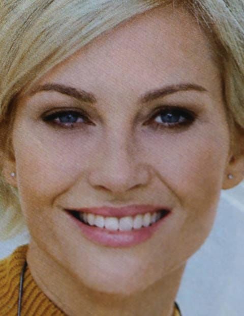 Figure 15. The patient wanted this model's teeth arrangement in her new denture