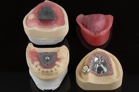 Figure 34. Technical work for visit 3. Central bearing apparatus to record centric relation. Wax rim to prescribe the maxillary tooth positions. Cobalt chromium base reinforcement for the maxillary partial denture.