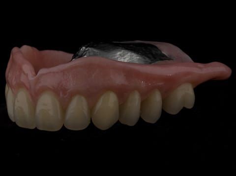 Figure 65. Definitive denture finished - Schottlander Enigmalife teeth
