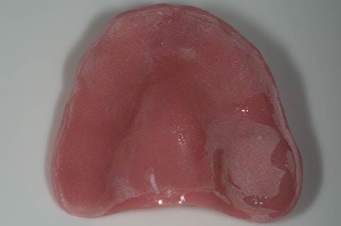 Figure 23. Intaglio surface of maxillary special tray spaced for definitive impression in alginate.