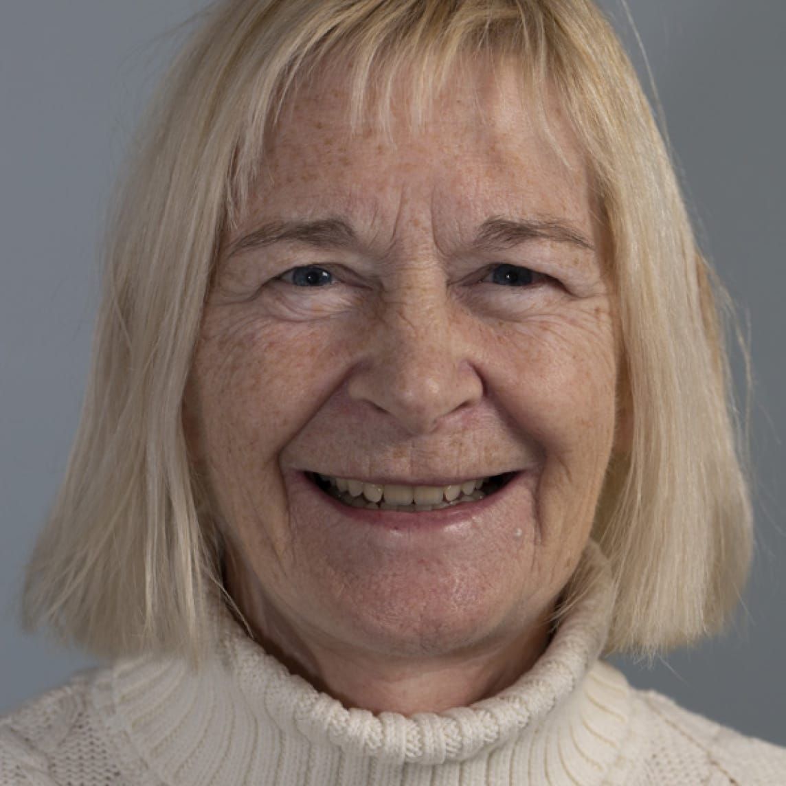 Immediate Dentures