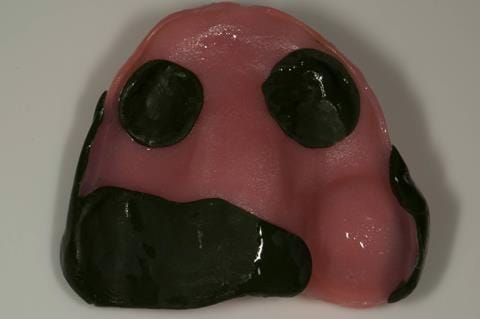 Figure 26. Maxillary special tray with application of greenstick to buccal surface after to border moulding in the mouth.