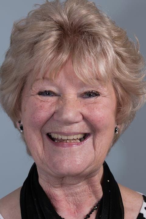 Figure 83. Fitted definitive denture