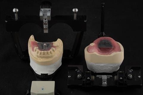 Figure 36. Technical work for visit 3. Central bearing apparatus to record centric relation (Gerber Condylator, Switzerland).