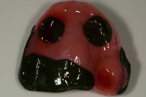 Figure 27. Maxillary special tray with alginate adhesive added prior to air drying to remove excess adhesive.