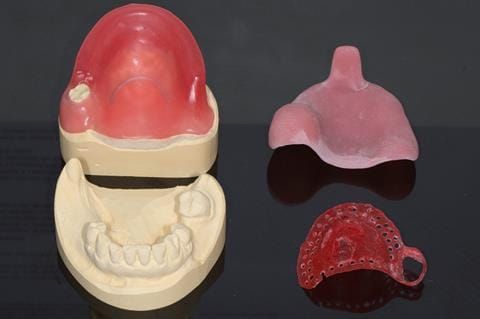 Figure 20. Mock up of cobalt chromium base in pattern resin to try in so that patient can assess where there will be visible metal in final denture.