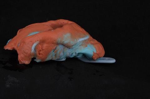 Figure 18. Maxillary primary impression made in two stages using Accudent XD, Ivoclar. This overextends the impression and captures the full depth of the sulcus. Please note this is from a different patient as I did not photograph the primary impressions.