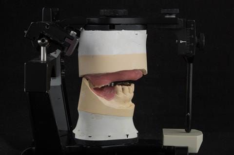 Figure 37. Technical work for visit 3. Central bearing apparatus to record centric relation (Gerber Condylator, Switzerland).