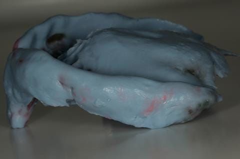 Figure 30. Maxillary special tray definitive impression made in alginate (Dentsply Blueprint) recording depth and width of sulcus..