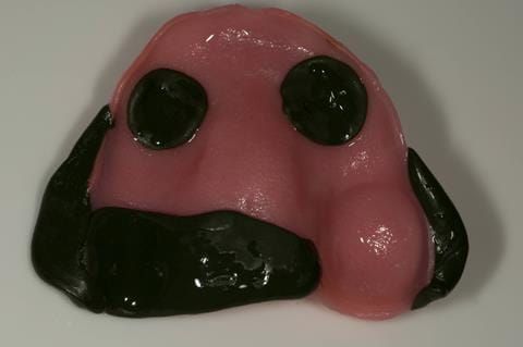 Figure 25. Maxillary special tray with application of greenstick to buccal surface prior to border moulding.