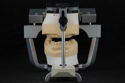 Figure 70.Definitive casts mounted in centric relation.