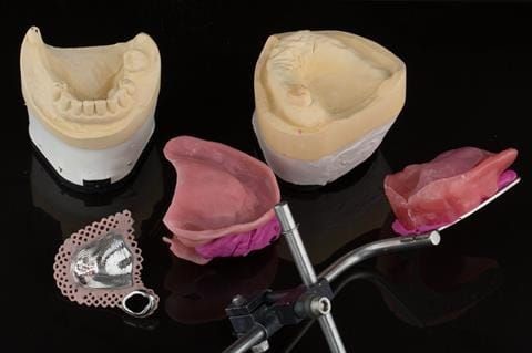 Figure 50. Post visit 3. This is the lab work sent to the dental technician. - central bearing apparatus, facebow transfer made on carved maxillary rim and cobalt chromium base. This enables construction of the try in - mock up.
