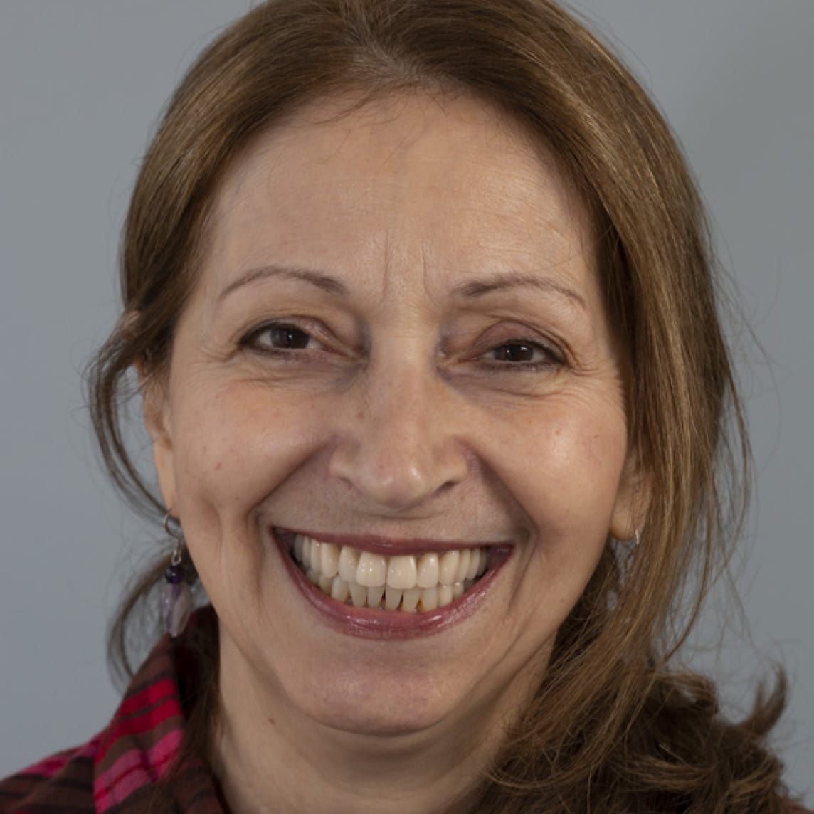 Removable Partial Dentures