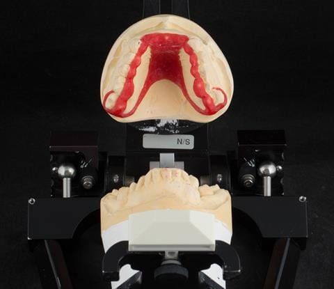 Figure 87. Pattern resin framework prototype of the cobalt chromium connectors to verify fit and occlusal relation - on Denar Mk 2 articulator.