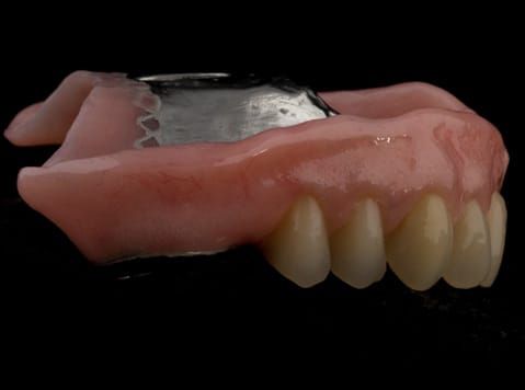 Figure 64. Definitive denture finished - Schottlander Enigmalife teeth