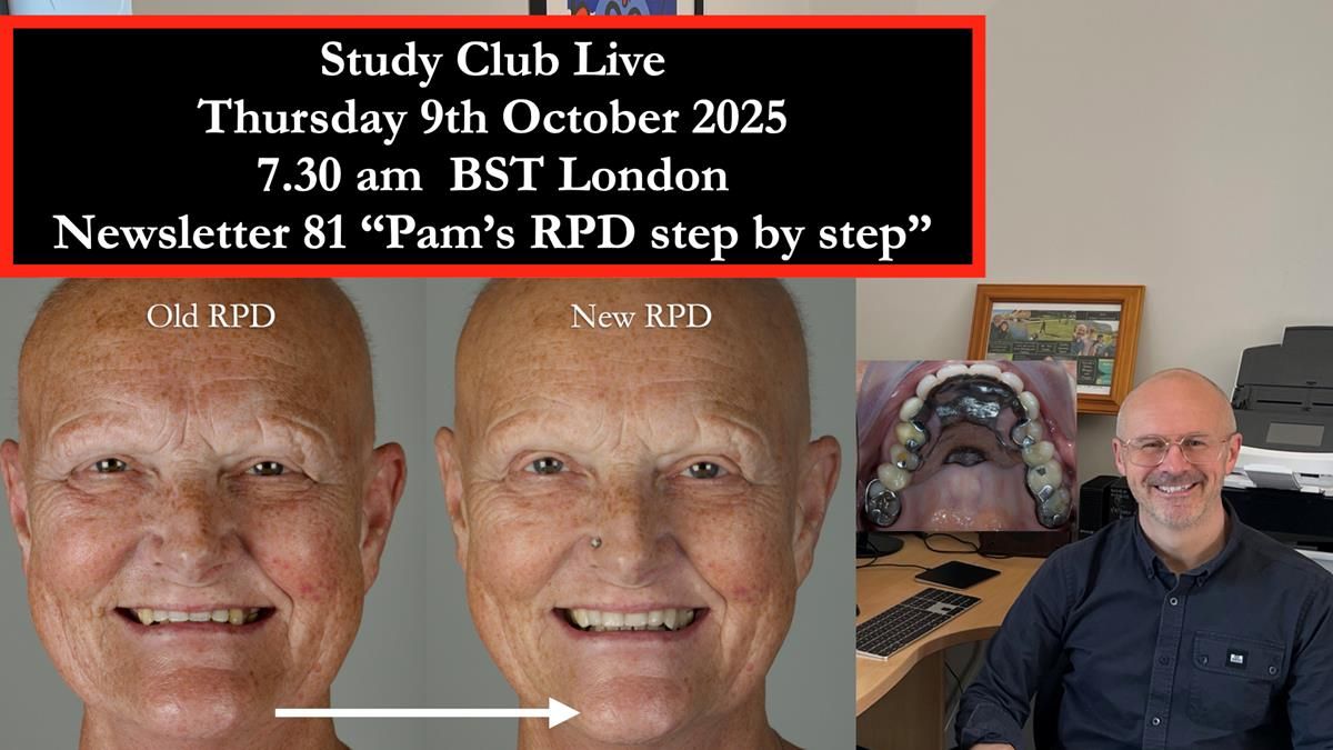 Newsletter 81 - Pam’s Story — how a partial denture changed her life (+ live walkthrough this Thursday)
