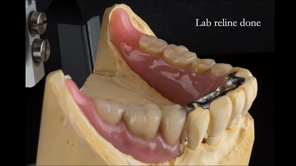 Ken – going downhill, first class