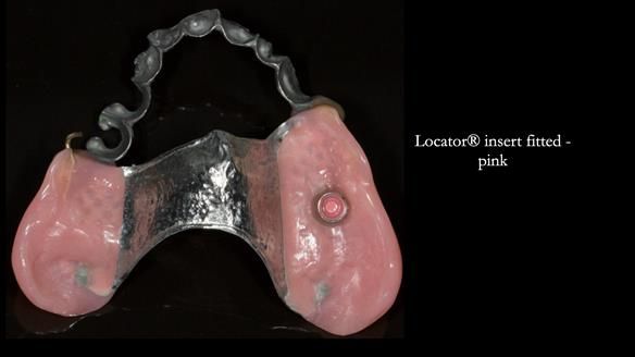 Ken – going downhill, first class