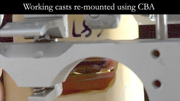 Finlay's Case Study Newsletter 40 - Immediate Mk 1 RPD to Definitive Mk 2 RPD - full protocol