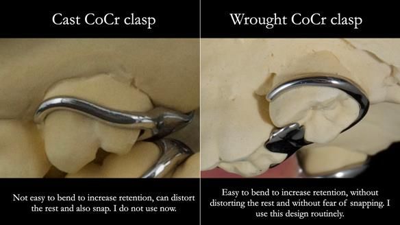 Newsletter 81 - Pam’s Story — how a partial denture changed her life (+ live walkthrough this Thursday)