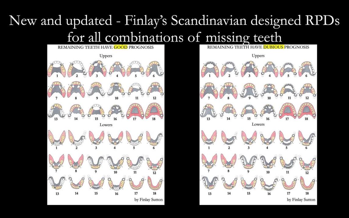Universal Scandinavian partial denture designs