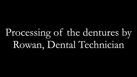 Finlay's Newsletter 58 Gasket upper partial denture for Zoe