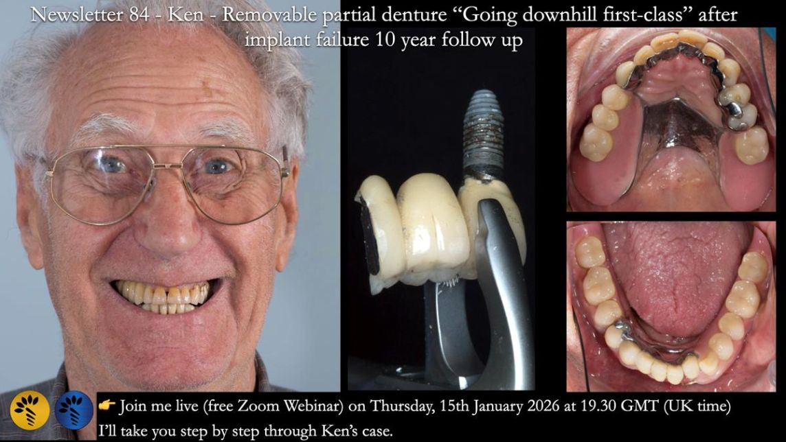 Ken – going downhill, first class