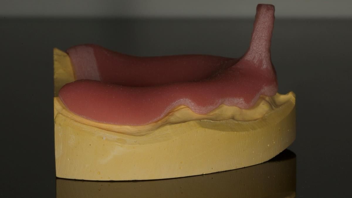 Newsletter 87 – Father Peter: A Partial Denture that needed Minor Miracle