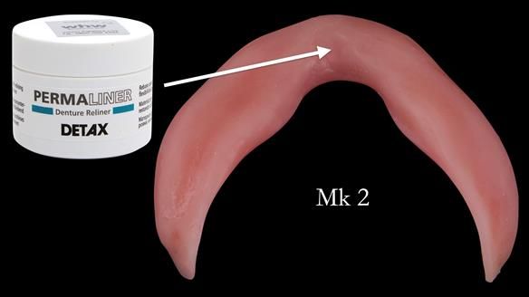 Replacing Madeline’s Complete denture FULL PROTOCOL