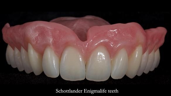 Newsletter 79 – Creating a wonderful smile and changing a life.