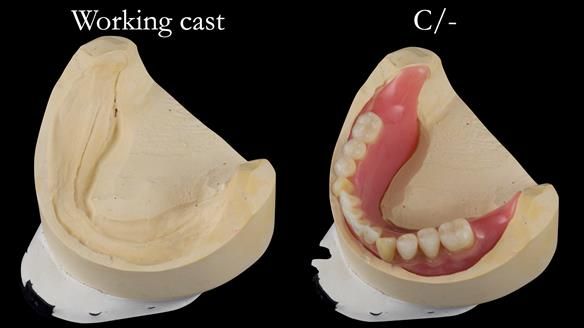 Newsletter 50 Special edition Complete Dentures FULL PROTOCOL