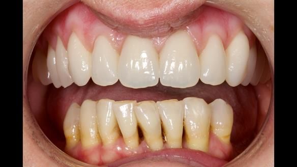 Newsletter 79 – Creating a wonderful smile and changing a life.