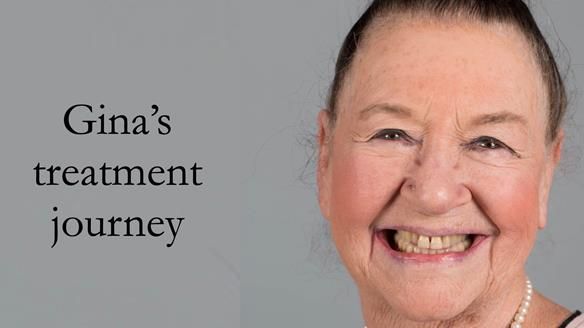 Finlay's Case Study Newsletter 40 - Immediate Mk 1 RPD to Definitive Mk 2 RPD - full protocol