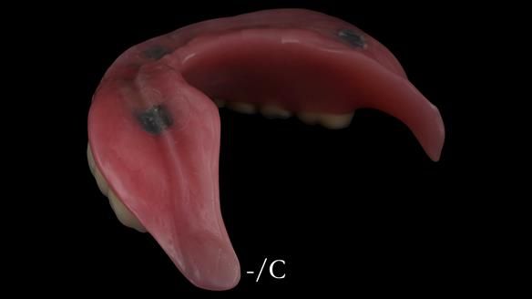 Newsletter 50 Special edition Complete Dentures FULL PROTOCOL