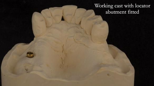 Ken – going downhill, first class