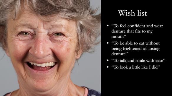 Solving Linda’s Failed “All on 4” implant bridges - full protocol Newsletter 42