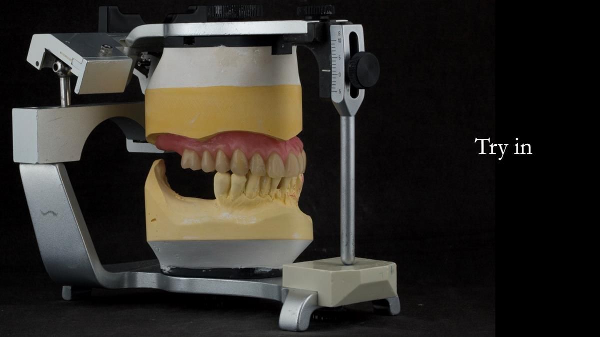Newsletter 87 – Father Peter: A Partial Denture that needed Minor Miracle