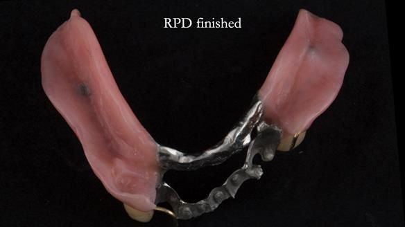 Ken – going downhill, first class