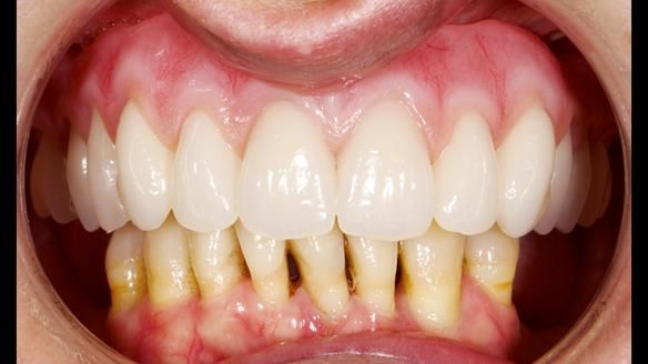 Newsletter 79 – Creating a wonderful smile and changing a life.