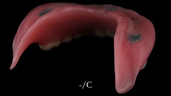 Newsletter 50 Special edition Complete Dentures FULL PROTOCOL