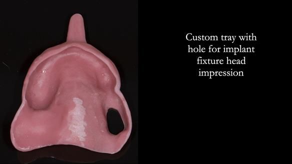 Ken – going downhill, first class