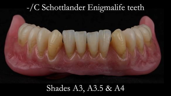 Newsletter 50 Special edition Complete Dentures FULL PROTOCOL