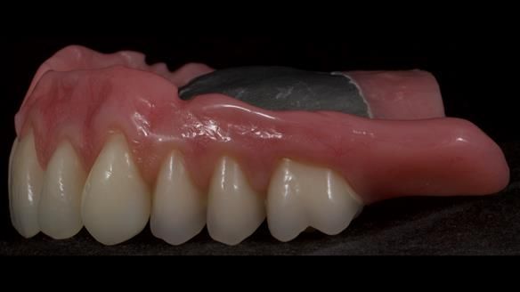 Newsletter 79 – Creating a wonderful smile and changing a life.