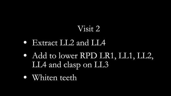 Newsletter 86 Peter the Architect — precision removable partial dentures case study