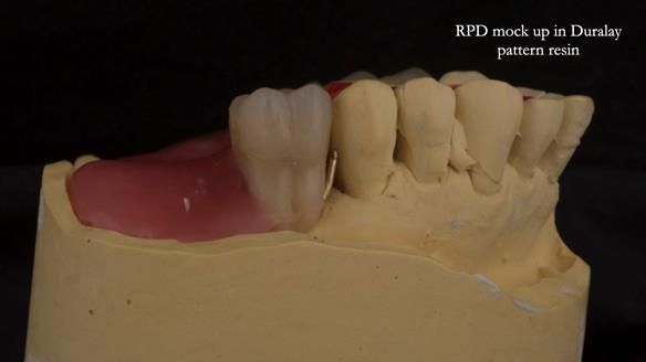 Ken – going downhill, first class