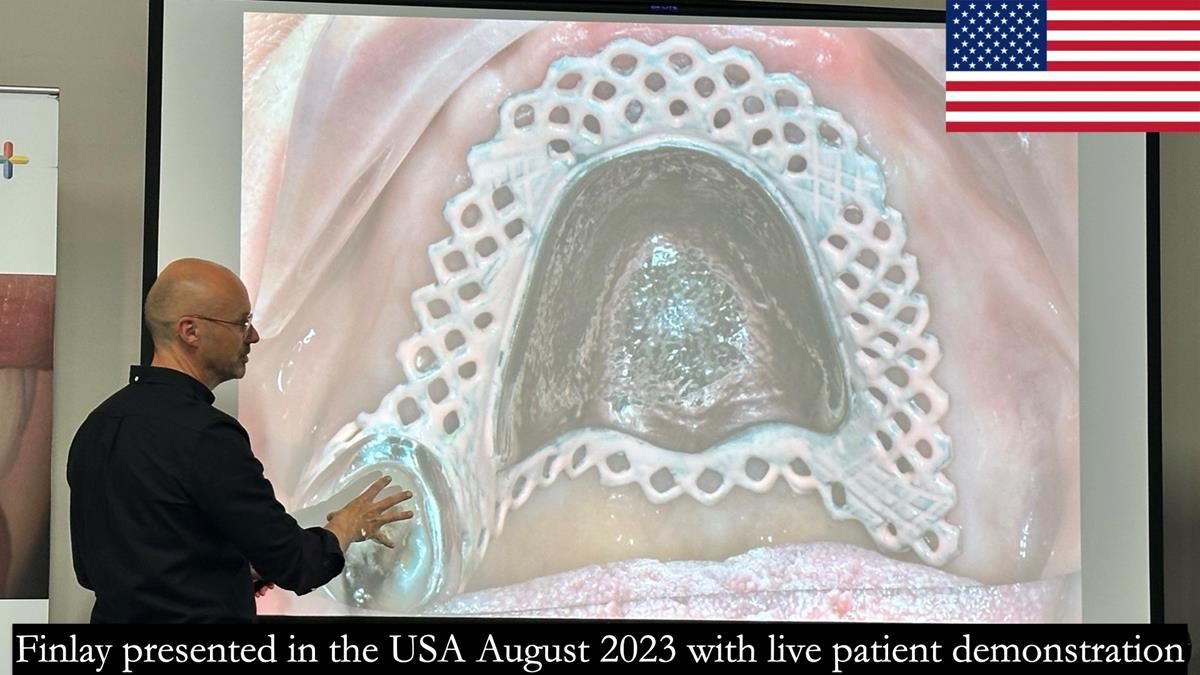 Finlay's Newsletter 59 Ultra hard partial dentures made for Gill