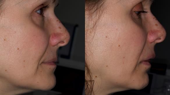 Newsletter 79 – Creating a wonderful smile and changing a life.