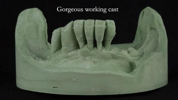 Ken – going downhill, first class